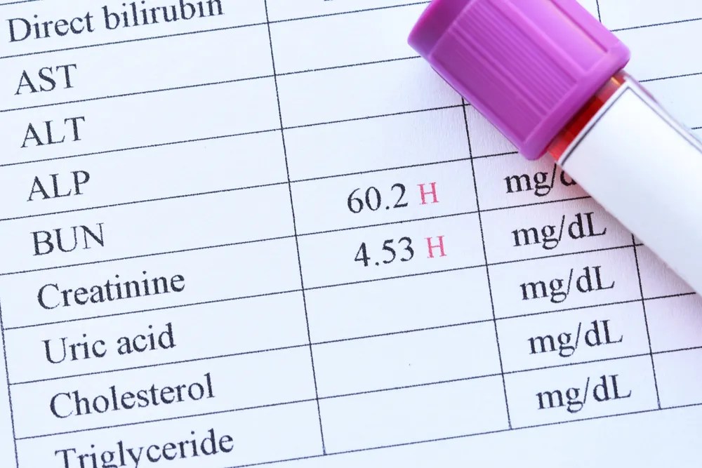 Low BUN Creatinine Ratio What Does It Indicate?